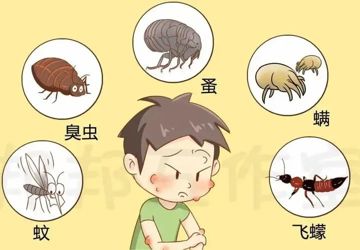 夏天蚊虫叮咬防治