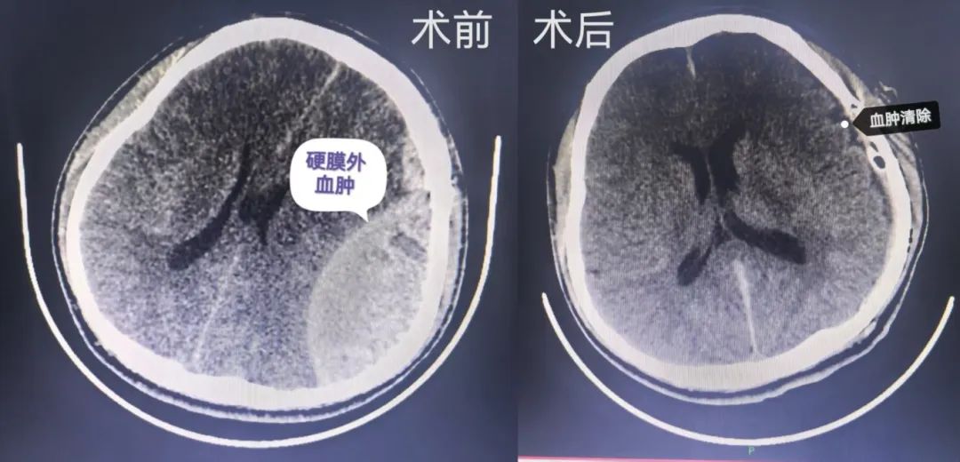 麻醉手术科的默契配合:为手术保驾护航