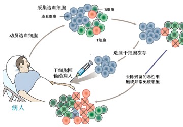 血液科-自体造血干细胞移植
